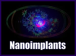 nano brain implant